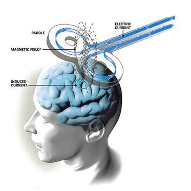 How TMS Therapy Works